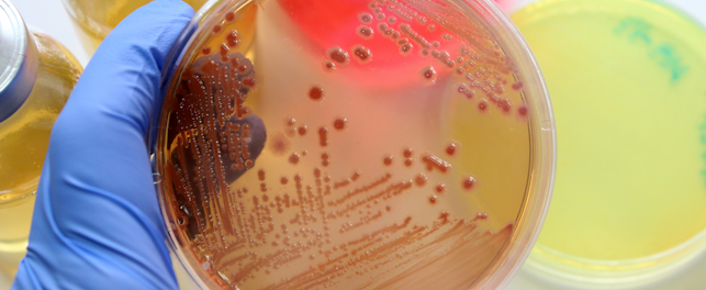 Standardy i certyfikacja podłoży mikrobiologicznych mają wpływ na jakość wyników badań.